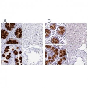 Anti-CLCA1 antibody produced in rabbit 