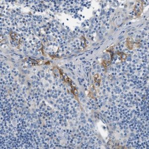 Anti-CLDN18 antibody produced in rabbit 