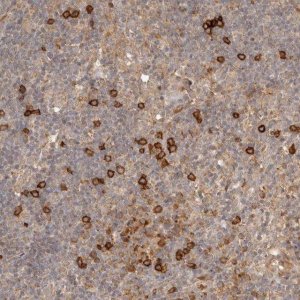 Anti-CLEC4C antibody produced in rabbit HPA029432-100UL