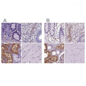 Anti-CLIC4 antibody produced in rabbit 
