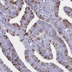 Anti-CLIC6 antibody produced in rabbit HPA055123-100UL