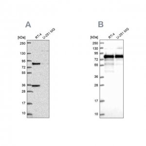 Anti-CLINT1 antibody produced in rabbit 