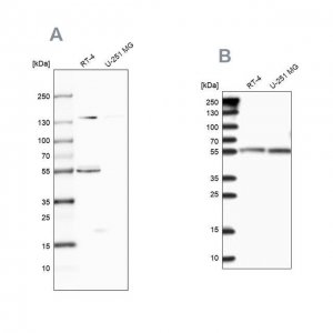 Anti-CLPB antibody produced in rabbit 