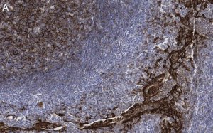 Anti-Clusterin Antibody, clone 2F23 ZooMAb� Rabbit Monoclonal 