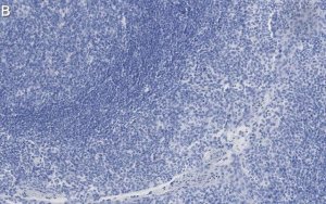 Anti-Clusterin Antibody, clone 2F23 ZooMAb� Rabbit Monoclonal 