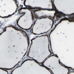 Anti-CMTM4 antibody produced in rabbit 