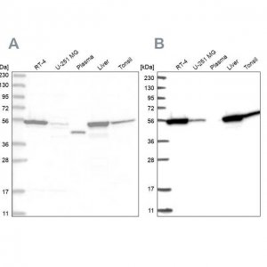 Anti-CNDP2 antibody produced in rabbit 