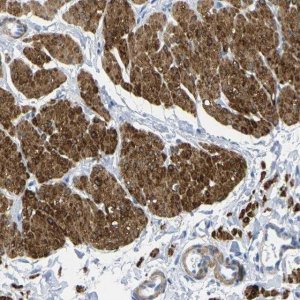 Anti-CNN1 antibody produced in rabbit 