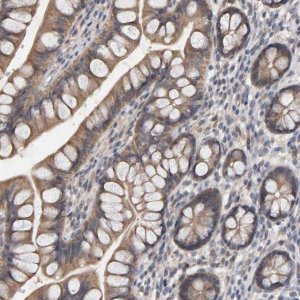 Anti-COASY antibody produced in rabbit HPA023273-100UL