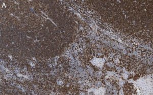 Anti-Cofilin-1 Antibody, clone 1C18 ZooMAb� Rabbit Monoclonal 