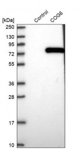 Anti-COG6 antibody produced in rabbit HPA040441-100UL
