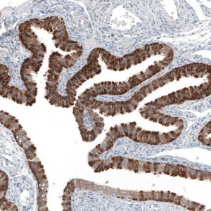 Anti-COL12A1 antibody produced in rabbit 