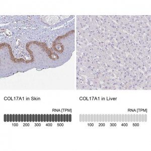 Anti-COL17A1 antibody produced in rabbit 