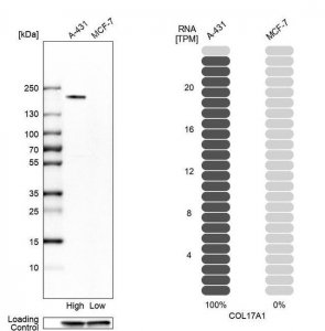 Anti-COL17A1 antibody produced in rabbit 