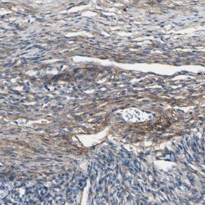 Anti-COL6A3 antibody produced in rabbit HPA010080-100UL