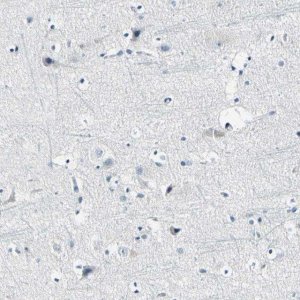 Anti-COL6A3 antibody produced in rabbit HPA010080-100UL