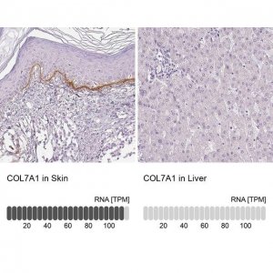 Anti-COL7A1 antibody produced in rabbit 