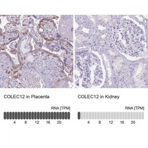 Anti-COLEC12 antibody produced in rabbit 