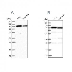 Anti-COPG1 antibody produced in rabbit 