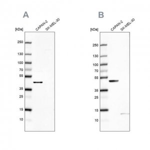 Anti-COQ2 antibody produced in rabbit HPA056599-100UL