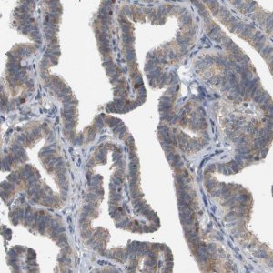 Anti-CORO2B antibody produced in rabbit 