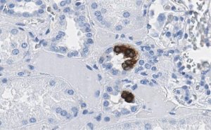 Anti-COX2 Antibody, clone 2B19 ZooMAb� Rabbit Monoclonal 