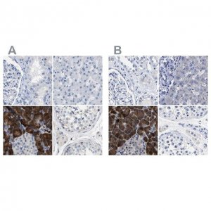 Anti-CPA2 antibody produced in rabbit 
