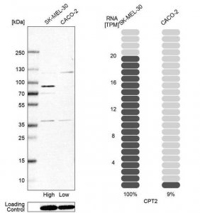 Anti-CPT2 antibody produced in rabbit 