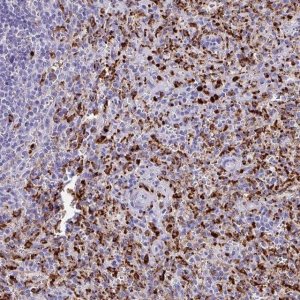 Anti-CPVL antibody produced in rabbit 