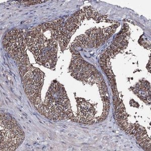Anti-CREB3L4 antibody produced in rabbit 