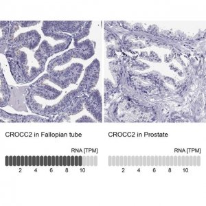 Anti-CROCC2 antibody produced in rabbit 
