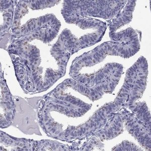 Anti-CROCC2 antibody produced in rabbit 