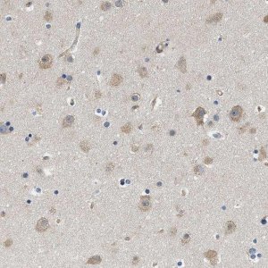Anti-CSDE1 antibody produced in rabbit 