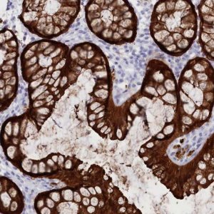 Anti-CSNK1G2 antibody produced in rabbit HPA034868-100UL