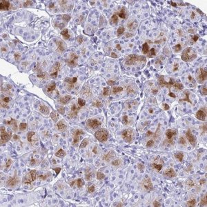 Anti-CST5 antibody produced in rabbit 