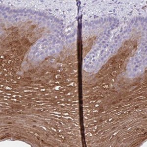 Anti-CSTB antibody produced in rabbit 