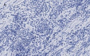 Anti-CTCF antibody, clone 1B18, ZooMAb� Rabbit monoclonal 