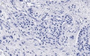 Anti-Cyclin D1 Antibody, clone 1J9, ZooMAb� Rabbit Monoclonal 