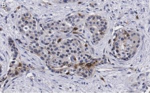 Anti-Cyclin D1 Antibody, clone 1J9, ZooMAb� Rabbit Monoclonal 