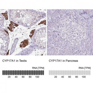 Anti-CYP17A1 antibody produced in rabbit HPA048533-100UL
