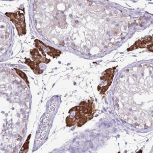Anti-CYP17A1 antibody produced in rabbit HPA048533-100UL
