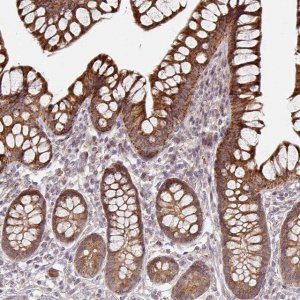Anti-CYP27A1 antibody produced in rabbit 