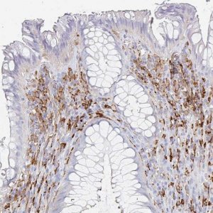 Anti-DAB2 antibody produced in rabbit 