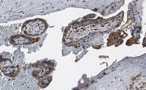 Anti-DAP Kinase 1 Antibody, clone 1J22 ZooMAb� Rabbit Monoclonal 