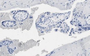 Anti-DAP Kinase 1 Antibody, clone 1J22 ZooMAb� Rabbit Monoclonal 