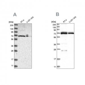 Anti-DARS2 antibody produced in rabbit 