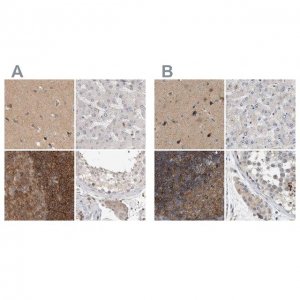 Anti-DBNL antibody produced in rabbit HPA027735-100UL