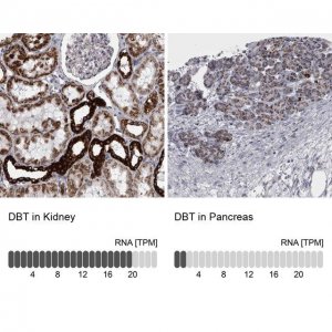Anti-DBT antibody produced in rabbit 
