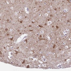Anti-DCLK2 antibody produced in rabbit 