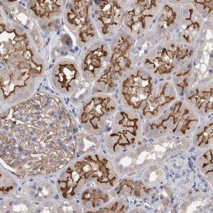 Anti-DCTN6 antibody produced in rabbit HPA024049-100UL